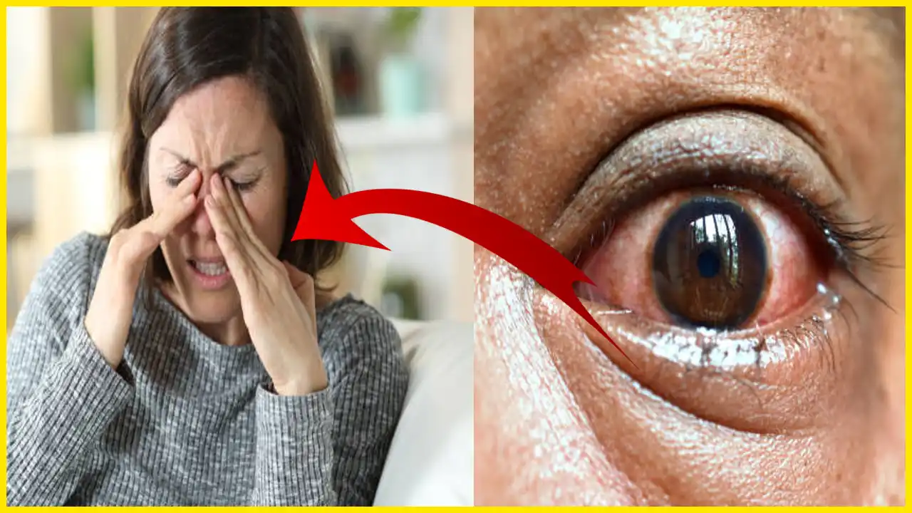 How to Keep Your Eyes Healthy and Prevent Conjunctivitis