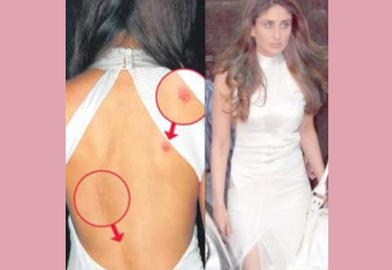 love_bite_kareena_kapoor.png